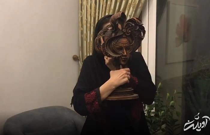 فلج شدن صورت سحر جعفری جوزانی